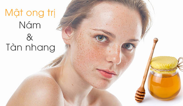 Mật ong giúp làm mờ các vết tàn nhang